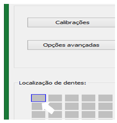 Câmera Intraoral Timex 2H Câmera intraoral Timex Câmera Intraoral Timex 2H Câmera intraoral Timex A câmera intraoral Timex é uma ferramenta poderosa. Com ela é possível exibir em tempo real para o paciente a situação da sua arcada, melhorando o poder de persuasão sobre a necessidade dos tratamentos. Também permite armazenar a situação dos dentes antes do tratamento, comparar com os resultados para melhorar o atendimento e aumentar a percepção de valor sobre o serviço prestado. Além da utilidade prática de facilitar a visualização de pequenos detalhes da arcada diretamente em uma tela de alta definição acoplada a cadeira odontológica.