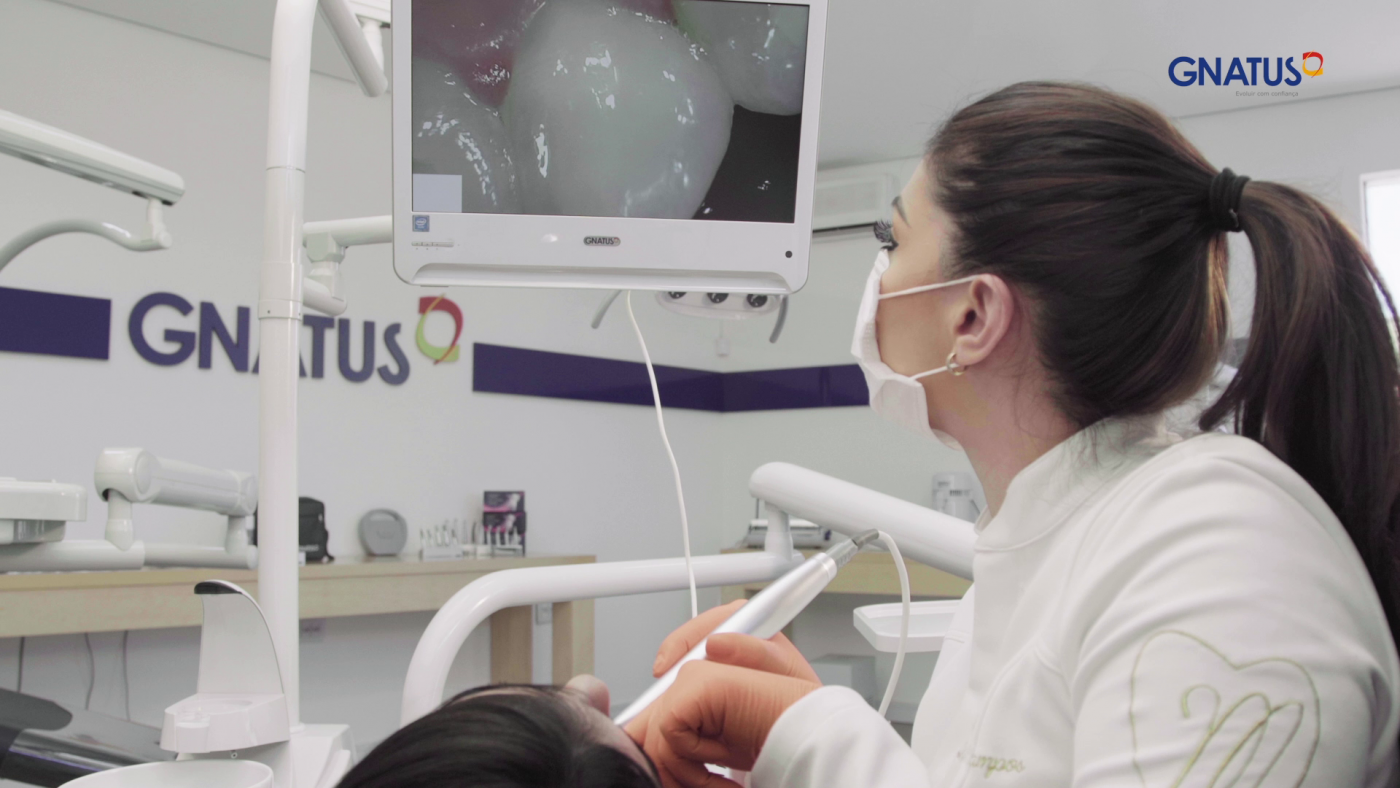 Câmera Intraoral Timex Gnatus Frete Grátis em 10x no cartão