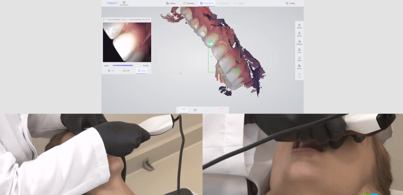 tecnologia 3D na odontologia