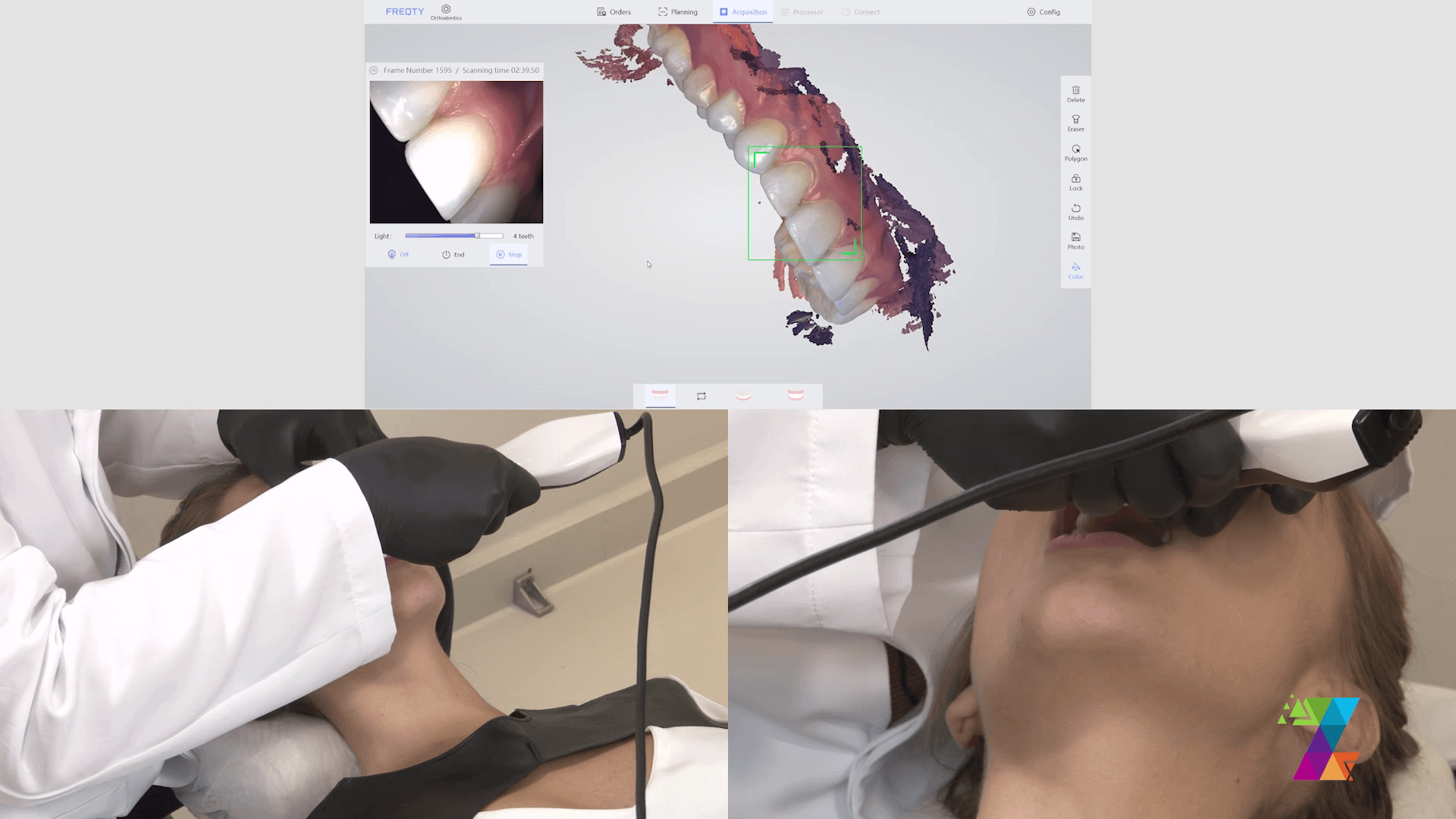 scanner-3d-gnatus-em-uso