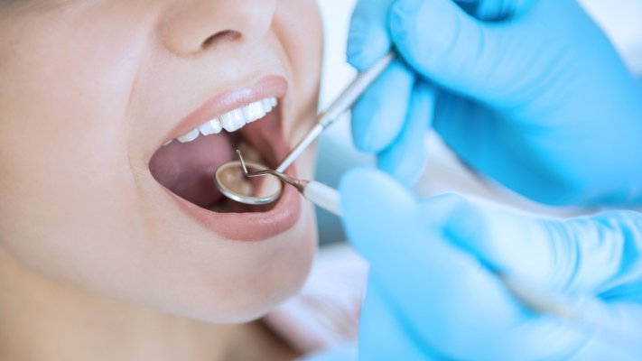 Pesquisadores brasileiros criam cimento odontológico que ajuda a prevenir cáries e placas bacterianas Mês do Dentista Pesquisadores da Faculdade de Odontologia de Ribeirão Preto (Forp), da USP, em conjunto com o Instituto de Química da Universidade Estadual de Campinas (Unicamp), criaram um cimento - utilizado na colagem das peças do aparelho ortodôntico - que evita a proliferação de bactérias, fungos e vírus.