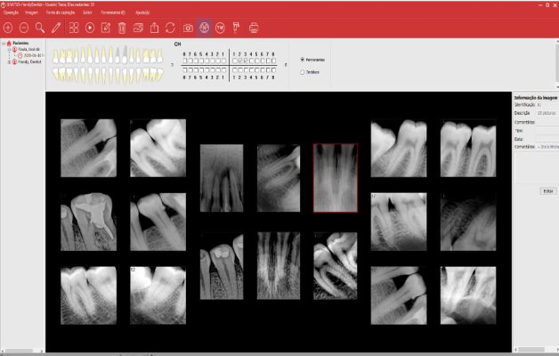 Consultório Digital Gnatus Somos apaixonados pela inovação e tecnologia e sabemos que você também. Afinal ela traz rapidez e praticidade no nosso dia a dia, com muita elegância. É por isso, que criamos um combo feito para você deixar a sua clínica o High tech com condições que só a Gnatus pode te oferecer. Leia até o final para descobrir o quanto esse combo foi feito para você.     O queridinho dos dentistas, consultório da linha G2, modelo C – com cart – que garante mobilidade e estilo. Em seu estofamento em couro o massageador para conquistar e relaxar qualquer paciente.     Em combinação especial com o kit multimídia, composto pelo computador All in One (monitor, teclado e mouse), Câmera Intra Oral S-ioC e Kit Suporte Monitor. Ideal para que você possa demonstrar em tempo real o que está acontecendo na boca do paciente.   Que também pode ser utilizado junto com o próximo item desse combo, que é o Scanner Intraoral Panda. Rápido, preciso e portátil, com um controlador de luminosidade, perfeito para você já garantir o molde da arcada do paciente, sem precisar de moldeiras e inúmeras tentativas.       Ainda seguindo essa linha do prático, você tem nesse consultório digital o nosso sensor de raio x digital timex, que te garante diagnósticos sem risco e uma qualidade de imagem insuperável em menos de 5 segundos.               E se você já está achando perfeito, a gente achou que tinha que ter mais... colocamos também nesse combo um micromotor elétrico, o menor e mais silencioso do mercado e um multiplicador M5 1:5. Para deixar você pronto para todos os procedimentos.     E o preço? Só posso dizer que é imperdível. Deixe seu contato que nosso consultor te dará mais detalhes: