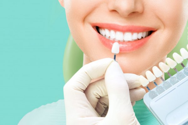 Técnicas para restaurar a perda de esmalte A estética de um belo sorriso é importante, mas a perda de esmalte pode trazer outros problemas para o paciente. Por isso o profissional deve estar sempre atento e saber exatamente como proceder em caso de restauração.