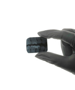 Filme Radiográfico Odontológico Autorrevelável Gnatus Filme autorrevelável gnatus Filme Radiográfico Odontológico Autorrevelável Gnatus Filme autorrevelável gnatus Caixa de filme radiográfico intraoral autorrevelador Gnatus (30,5 × 40,5 mm), pronta para uso sem câmara escura: revela e fixa em 50 segundos com menor exposição ao RX e alta definição. Material atóxico e não poluente, sem chumbo, cádmio ou tiossulfatos, com durabilidade de até 10 anos. Design ergonômico para posicionamento confortável (anteriores e posteriores) e compatibilidade com paralelismo e vídeo-radiografia digital.