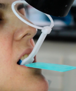 Filme Radiográfico Odontológico Autorrevelável Gnatus Filme autorrevelável gnatus Filme Radiográfico Odontológico Autorrevelável Gnatus Filme autorrevelável gnatus Caixa de filme radiográfico intraoral autorrevelador Gnatus (30,5 × 40,5 mm), pronta para uso sem câmara escura: revela e fixa em 50 segundos com menor exposição ao RX e alta definição. Material atóxico e não poluente, sem chumbo, cádmio ou tiossulfatos, com durabilidade de até 10 anos. Design ergonômico para posicionamento confortável (anteriores e posteriores) e compatibilidade com paralelismo e vídeo-radiografia digital.