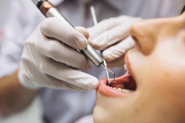 3 produtos indispensáveis nos procedimentos endodônticos
