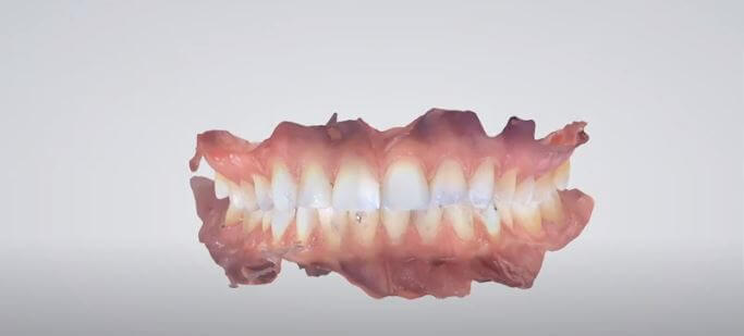 As vantagens de digitalizar seu consultório As tecnologias, por meio de softwares de gestão, equipamentos odontológicos 3D, entre outros recursos, além de aumentar a precisão e diminuir o tempo das consultas está aumentando a lucratividade dos dentistas. Garantindo sempre o melhor dos tratamentos para os pacientes. Por isso, fique atento aos pontos que iremos elencar neste texto das vantagens que a odontologia digital tem a te oferecer.