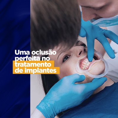Uma oclusão perfeita no tratamento de implantes Uma das grandes responsáveis pela durabilidade de um tratamento protético está na perfeição da oclusão. Por isso para se tornar referência no assunto o implantodontista tem que saber e colocar em prática o procedimento para uma oclusão perfeita e “testar” a mordida e realizar todos os ajustes necessários.