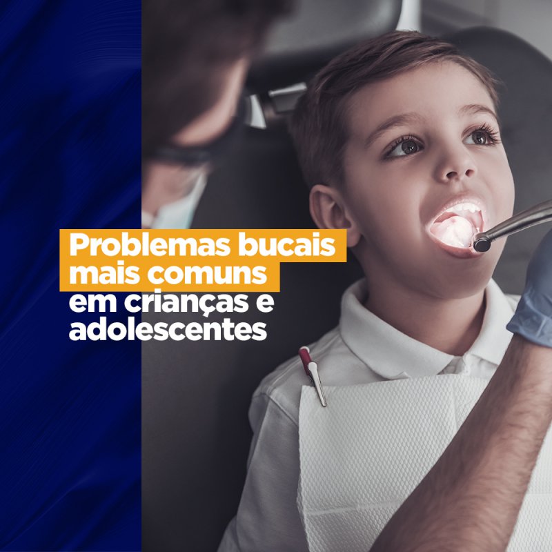 Problemas bucais mais comuns em crianças e adolescentes Problemas bucais mais comuns em crianças e adolescentes Sabemos que o cuidado com a saúde bucal não tem idade e que problemas dentários podem aparecer independentemente da idade. Mas algumas situações são mais comuns em certas faixas etárias, você sabe quais são?