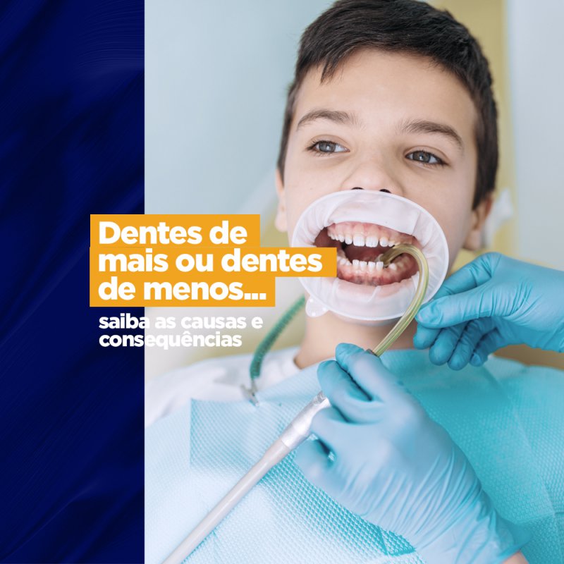 Dentes de mais ou dentes de menos...saiba as causas e consequências dentes a mais ou a menos