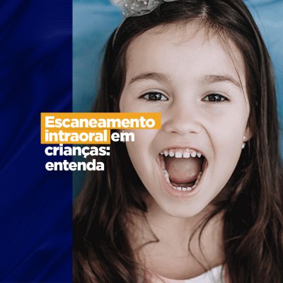 Escaneamento intraoral em crianças: Entenda A tecnologia 3D na odontologia vem se mostrando importante e facilitadora no dia-a-dia do odontologista. Da mesma maneira que é usada para pacientes adultos ela pode ser usada nas consultas com os pequenos.