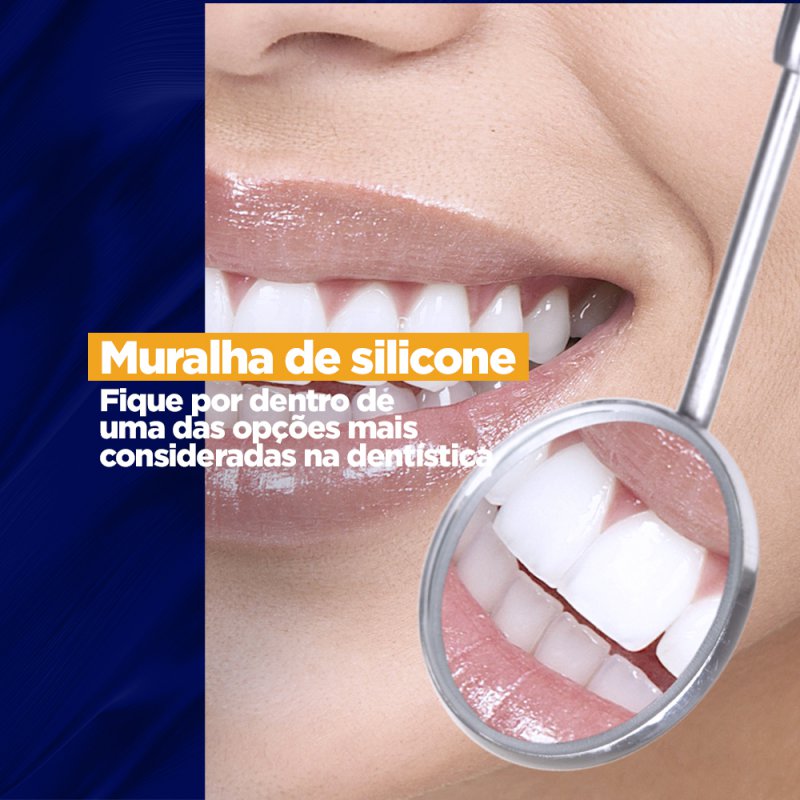 Muralha de silicone: fique por dentro de uma das opções mais consideradas na dentística Muralha de silicone: fique por dentro de uma das opções mais consideradas na dentística A técnica para reconstrução dos dentes anteriores com fraturas ou restaurações envolvendo o ângulo incisal, que oferece uma cópia ideal da estrutura palatina, vem sendo a queridinha dos profissionais da odontologia por oferecer uma grande vontade para os pacientes.