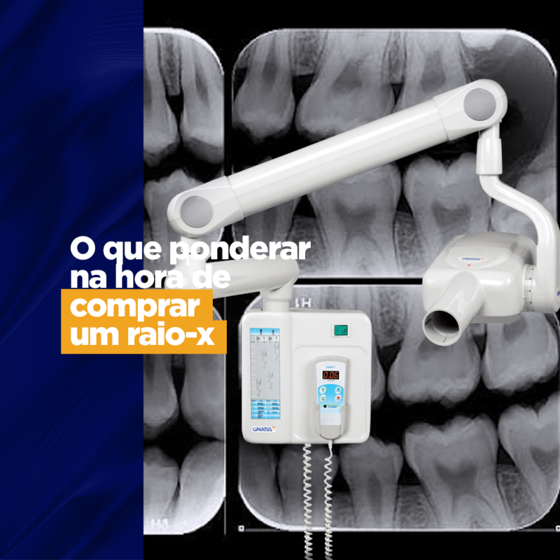 O que ponderar na hora de comprar um raio-x O que ponderar na hora de comprar um raio-x Uma das primeiras coisas que se deve considerar quando se procura por equipamentos odontológicos é o espaço a onde eles serão colocados. No raio-x essa questão é tão importante que se destaca entre as características das opções de produtos, mas existem outros pontos a se analisar antes da compra.