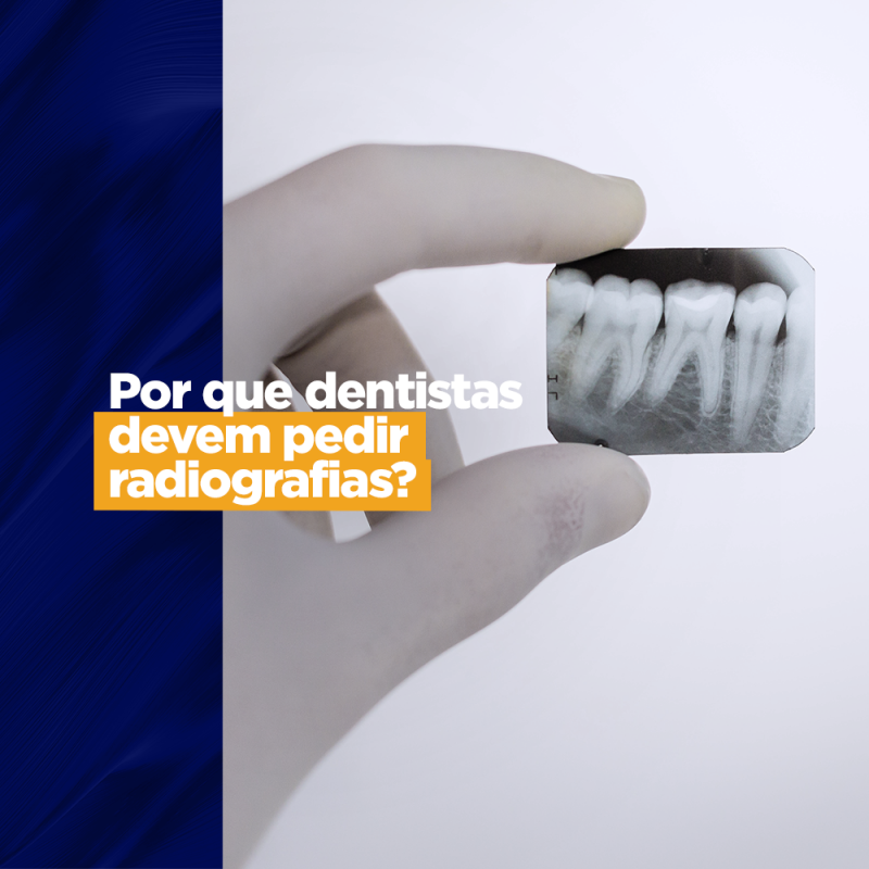 Por que dentistas devem pedir radiografias? radiologia odontológica radiografia