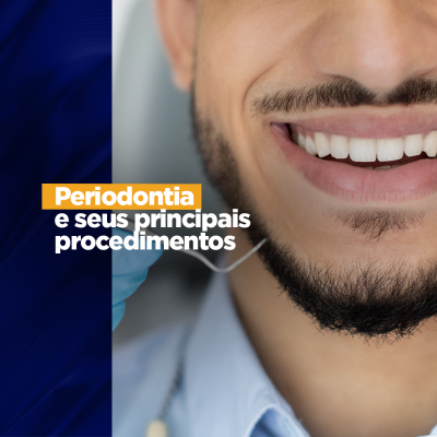 Periodontia e seus principais procedimentos cirurgias gengivais A periodontia tem diferentes ramos de atuação e os dentistas que se interessam por essa área tem um vasto campo de trabalho. Vamos indicar aqui um pouco sobre a periodontia e seus procedimentos. Você já conhece tudo?