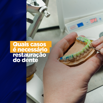 Quais casos é necessário restauração do dente Fazemos ferramentas para prover sorriso, pois, acreditamos na importância que ele tem. Afinal ele é o grande sinal de que coisas boas estão acontecendo, também é considerado uma forma de demonstrar carinho. Com tudo isso você já imaginou não ter um belo sorriso para tudo isso?