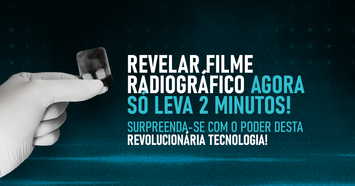 20% de Desconto na Compra do Filme Radiográfico Auto Revelável Deixe seus dados que um consultor entrará em contato: