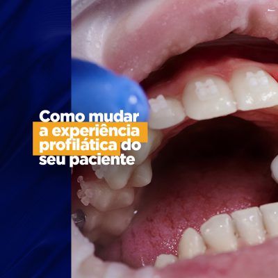 Como mudar a experiência profilática do seu paciente experiência profilática do seu paciente Hoje o consumo tem muito foco na experiência, mas na odontologia a experiência do paciente na cadeira para atendimento sempre foi algo que importa muito, por isso, saiba como mudar a experiência profilática do seu paciente no seu consultório e causar uma boa impressão.