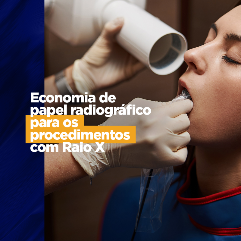 Economia de papel radiográfico para os procedimentos com Raio X preciso para o CIOSP Economia de papel radiográfico