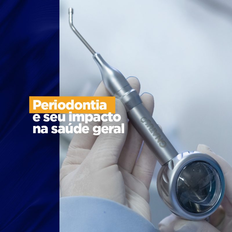 Periodontia e seu impacto na saúde geral marketing odontológico Periodontia e seu impacto na saúde geral marketing odontológico A higienização bucal quando não é feita de maneira adequada, favorece o acúmulo de bactérias na superfície dos dentes, podendo gerar a inflamação da gengiva (gengivite) que se não for tratada pode progredir para uma periodontite e essa doença pode afetar a saúde geral do paciente. Por tanto a periodontia tem impacto na saúde geral.