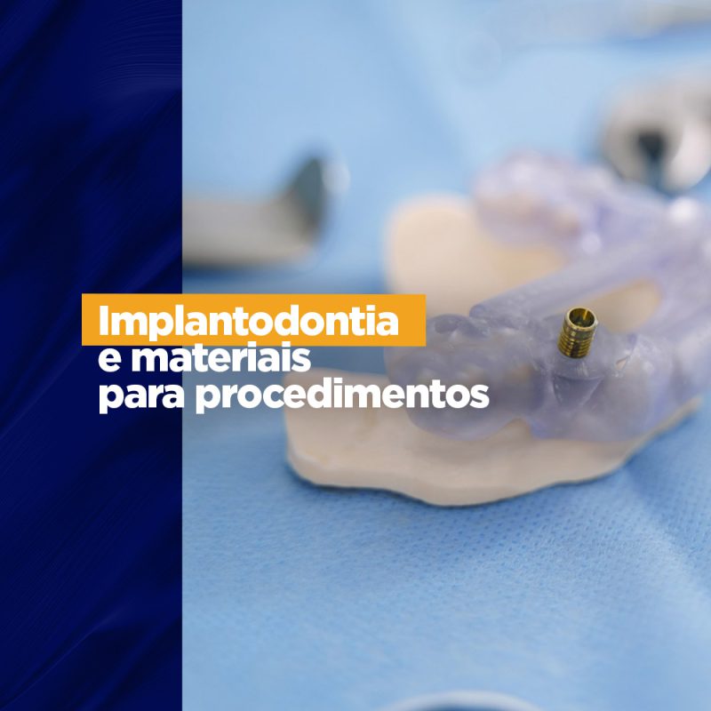 Implantodontia e os materiais para procedimentos Ergonomia odontológica Implantodontia e os materiais para procedimentos Ergonomia odontológica O implante é comum na boca de muitos brasileiros ou a necessidade dele e um bom profissional precisa conhecer tudo sobre o assunto e os principais matérias para usar. Então venha com a gente saber sobre a implantodontia e os materiais para procedimento.