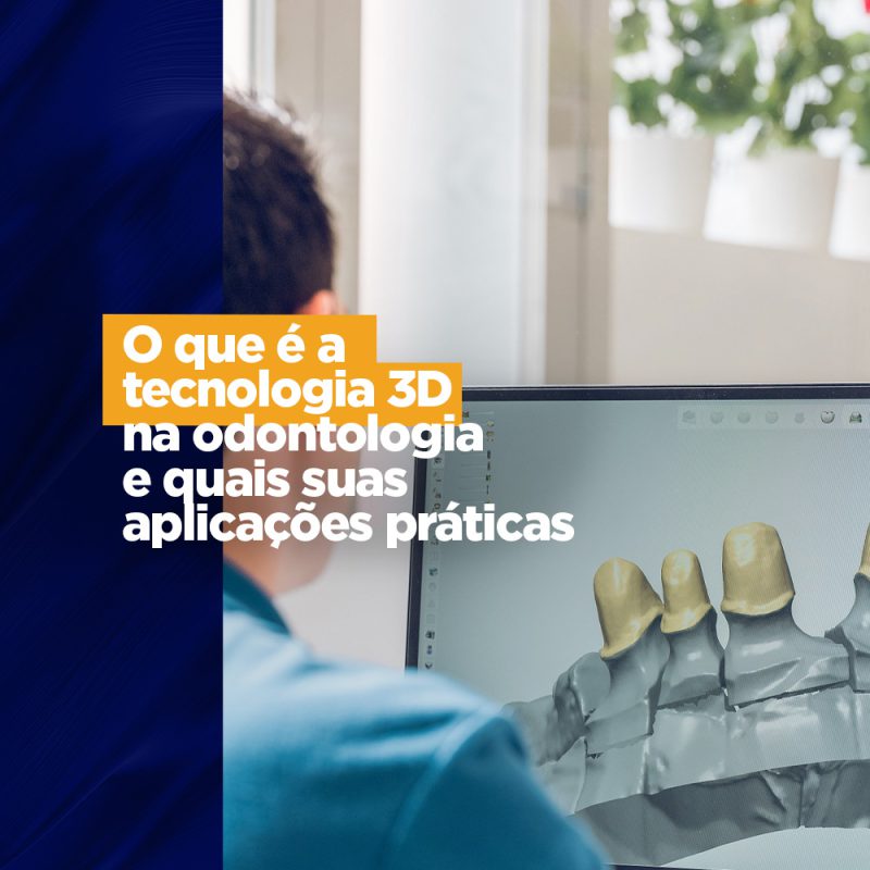 O que é a tecnologia 3D na odontologia e quais suas aplicações práticas Férias escolares consultório O que é a tecnologia 3D na odontologia e quais suas aplicações práticas Férias escolares consultório A tecnologia 3D na odontologia dá outra perspectiva para o dentista que pode visualizar de forma mais clara e precisa a cavidade bucal e suas estruturas, como os dentes e sua raízes, o maxilar e a mandíbula.