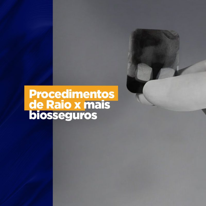 Filmes radiográficos odontológicos : Procedimentos de Raio-x mais biosseguros Férias escolares consultório Raio-x mais biosseguros