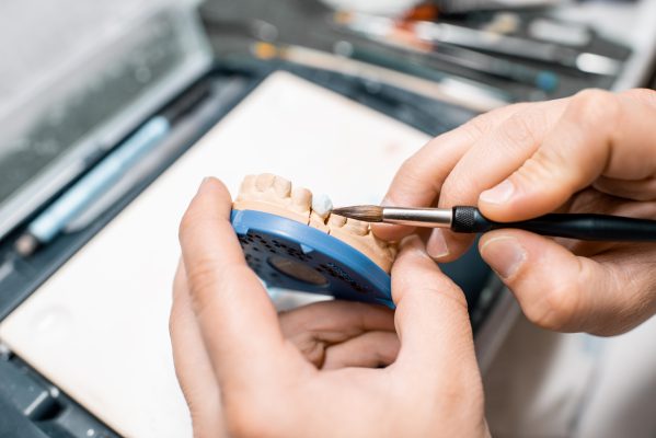 restauração dentária