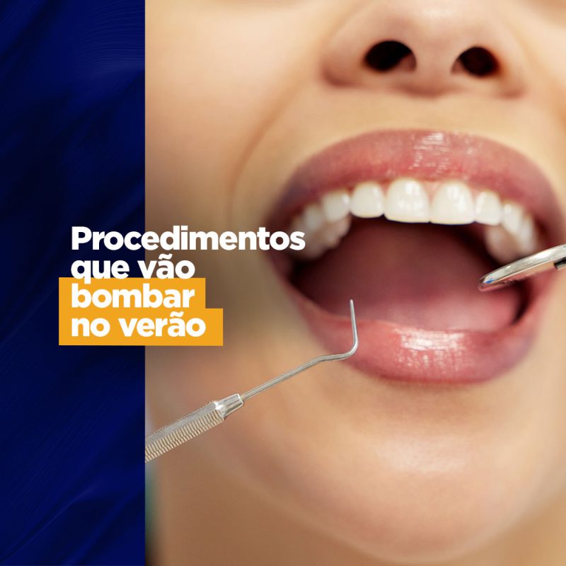 Procedimentos que vão bombar no verão radiologia odontológica procedimentos no verão