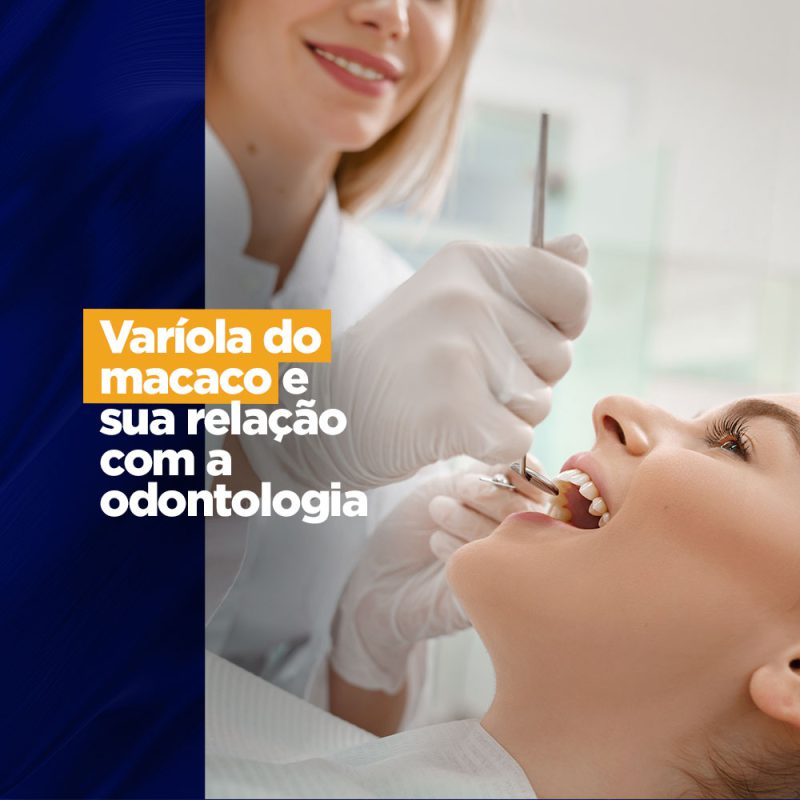 Varíola do macaco e sua relação com a odontologia varíola do macaco varíola do macaco