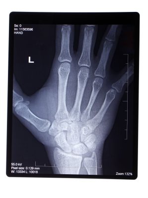 radiologia odontológica