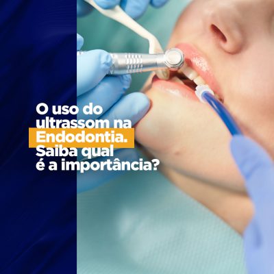 O uso do ultrassom na Endodontia: saiba qual é a importância rotina mais leve O ultrassom odontológico traz diversos benefícios nas mais diversas áreas, e é importante aliado do profissional dentista.
