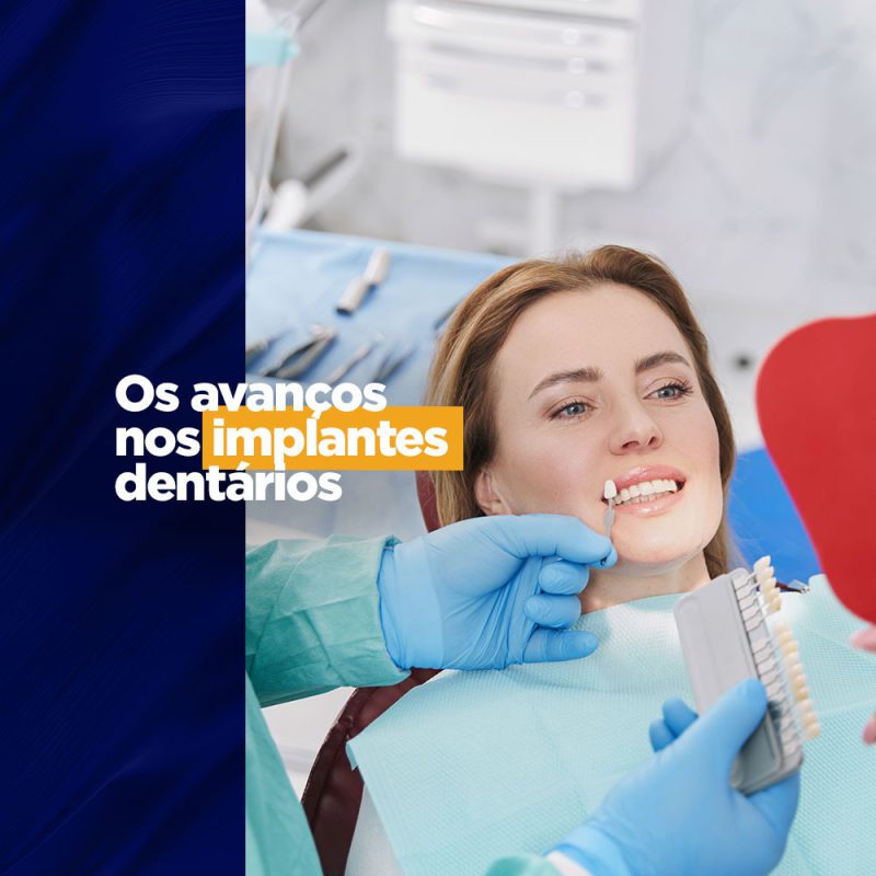 Os avanços nos implantes dentários radiografias Os avanços nos implantes dentários inscrição Os avanços tecnológicos estão a cada dia ocupando mais espaço dentre as atividades do ser humano. No universo profissional do protético a clássica figura da dentadura vem evoluindo para próteses moveis e implantes dentários que podem ser produzidos com o auxílio de equipamentos com tecnologia 3D.