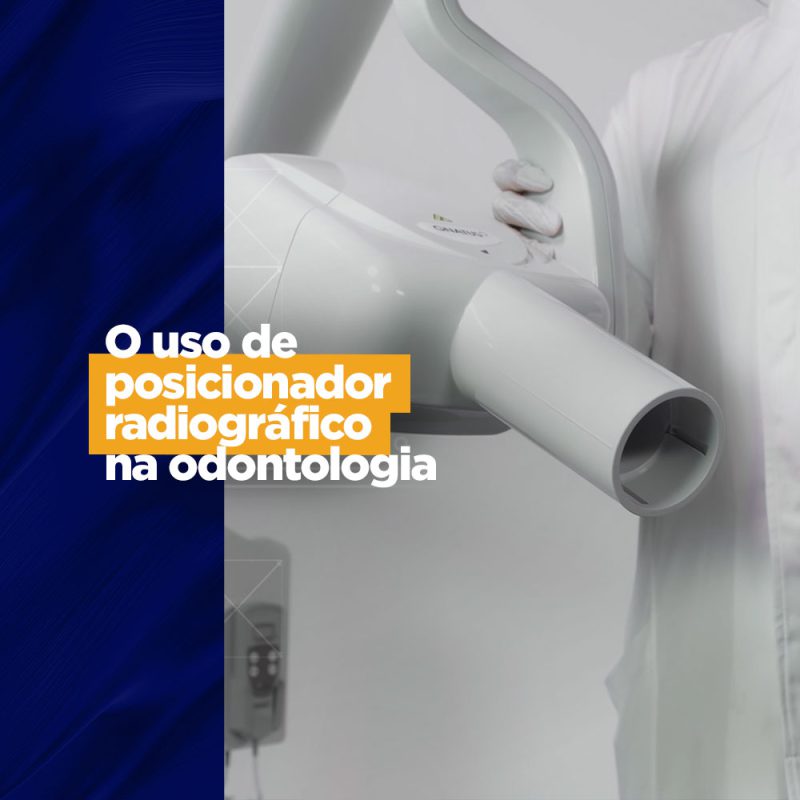 O uso de posicionador radiográfico na odontologia Tudo o que você precisa para o 40º CIOSP O uso de posicionador radiográfico na odontologia Tudo o que você precisa para o 40º CIOSP Sabemos e defendemos os procedimentos de imagem na dinâmica de um atendimento odontológico e para a execução de uma radiografia de sucesso é preciso um posicionador radiográfico. Mas você conhece os posicionadores e sabe como escolher o melhor para o seu consultório?