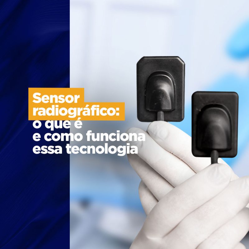 Sensor radiográfico o que é e como funciona essa tecnologia Sensor radiográfico Sensor radiográfico