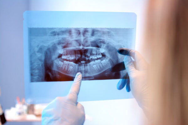Dentista analisa radiografia com aparelho de raio X odontológico para diagnóstico preciso
