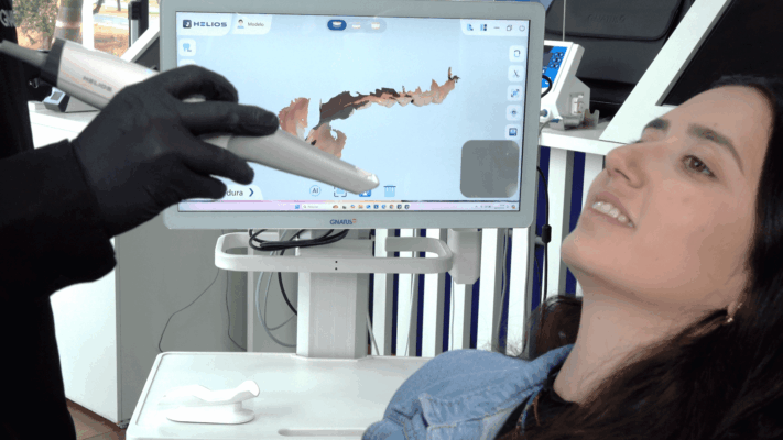 Paciente sendo atendida com escâner intraoral digital em um consultório odontológico, com visualização em tempo real do modelo 3D na tela do equipamento Helios da Gnatus.