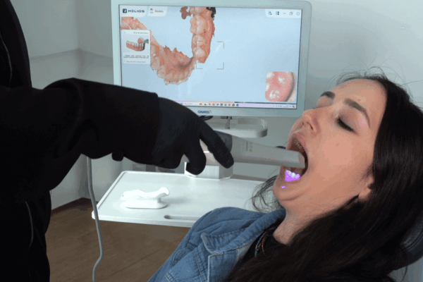 Dentista utilizando scanner intraoral 3D para capturar imagem digital da arcada dentária da paciente em consultório odontológico