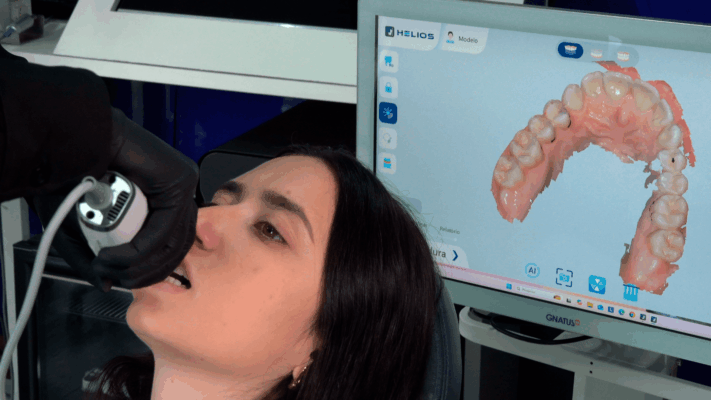 Dentista realizando moldagem digital em paciente com scanner intraoral enquanto modelo 3D da arcada dentária aparece na tela do computador.