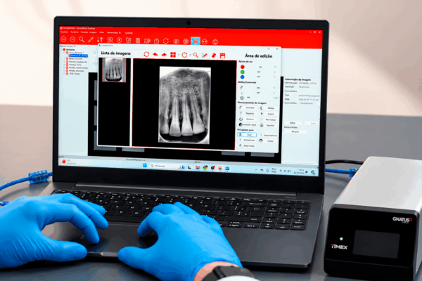 Radiografia intraoral digital exibida em notebook conectado a equipamento odontológico.